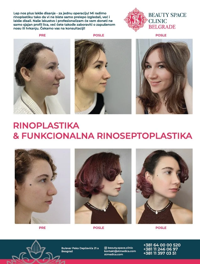 beauty space clinic rinoplastika